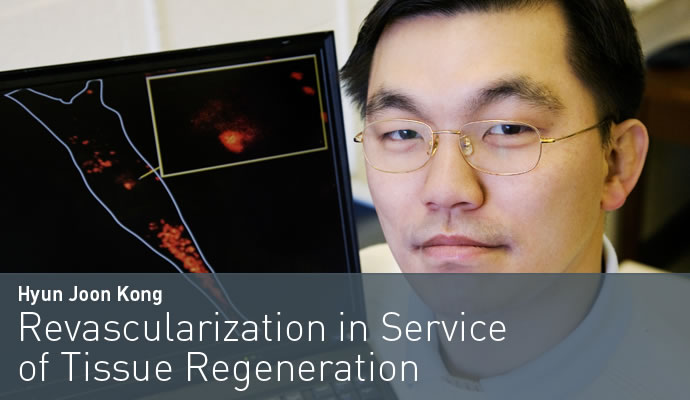 Hyun Joon Kong: Revascularization in Service of Tissue Regeneration