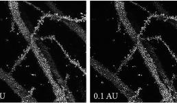 Golgi-Cox impregnated murine hippocampal neurons