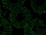 NanoZoomer Sample Image - Carly