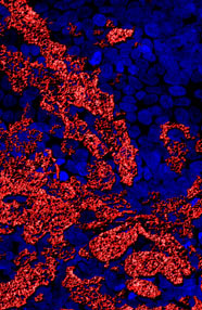 August 2010, LS174T cells expressing Sulfo Lea Antigen. Image Provided by Jennifer Croix, Rex Gaskins Lab