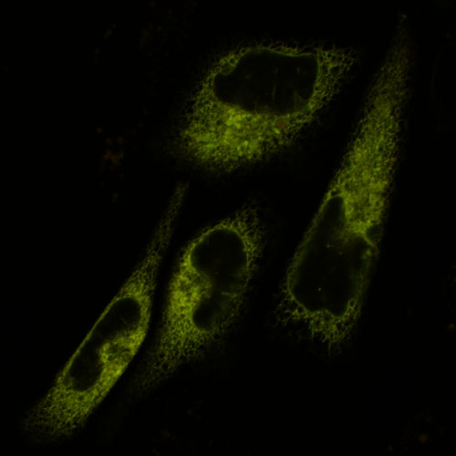January 2011, CHO cells labeled with redox thiol probe roGFP1-iL targeted to the Endoplasmic Reticulum
Instrument: Zeiss 700 Image Provided by Vladimer Kolossov and Matthew Leslie from the Gaskins lab.