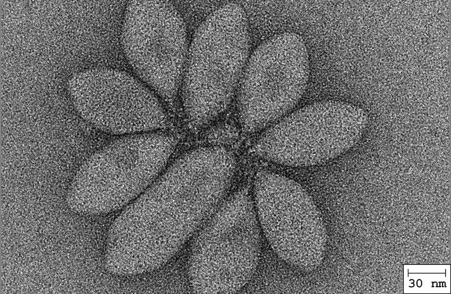 Transmission Electron Micrographs (TEM) of SSVs isolated from the Kamchatka Peninsula in Russia