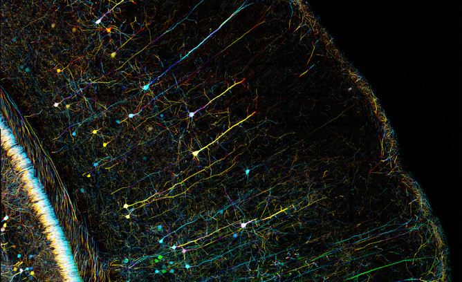 Neurons got the early glory, but don’t forget the genes. ZEISS Microscopy, CC BY-NC-ND