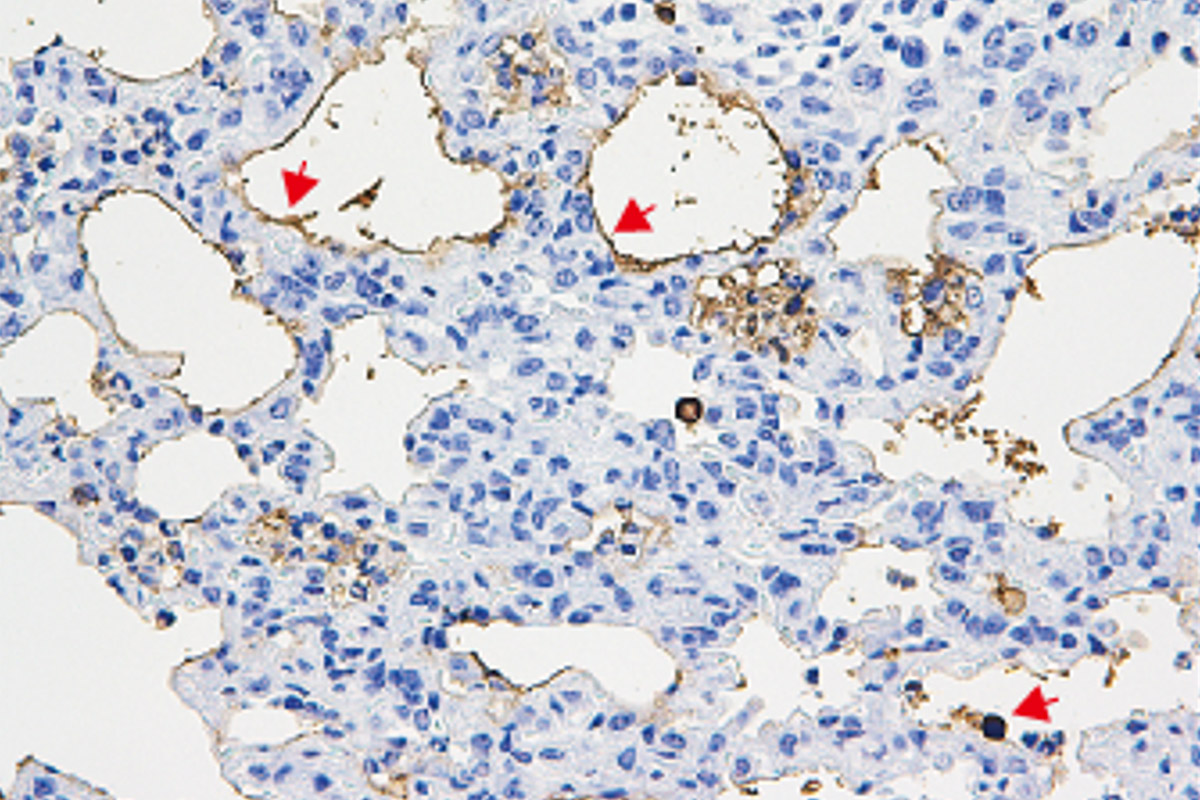 Lung tissue from mice with pulmonary fibrosis that were infected with corisin-secreting bacteria showed signs of acute exacerbation and lung tissue death.