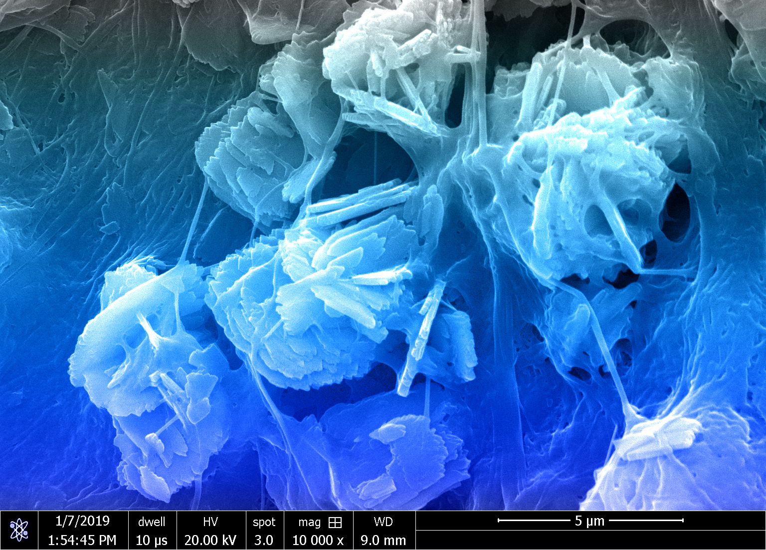 Electron microscope image of the mineralized collagen scaffold showing the mineral crystals and collagen fibers. The color has been added by the researchers.