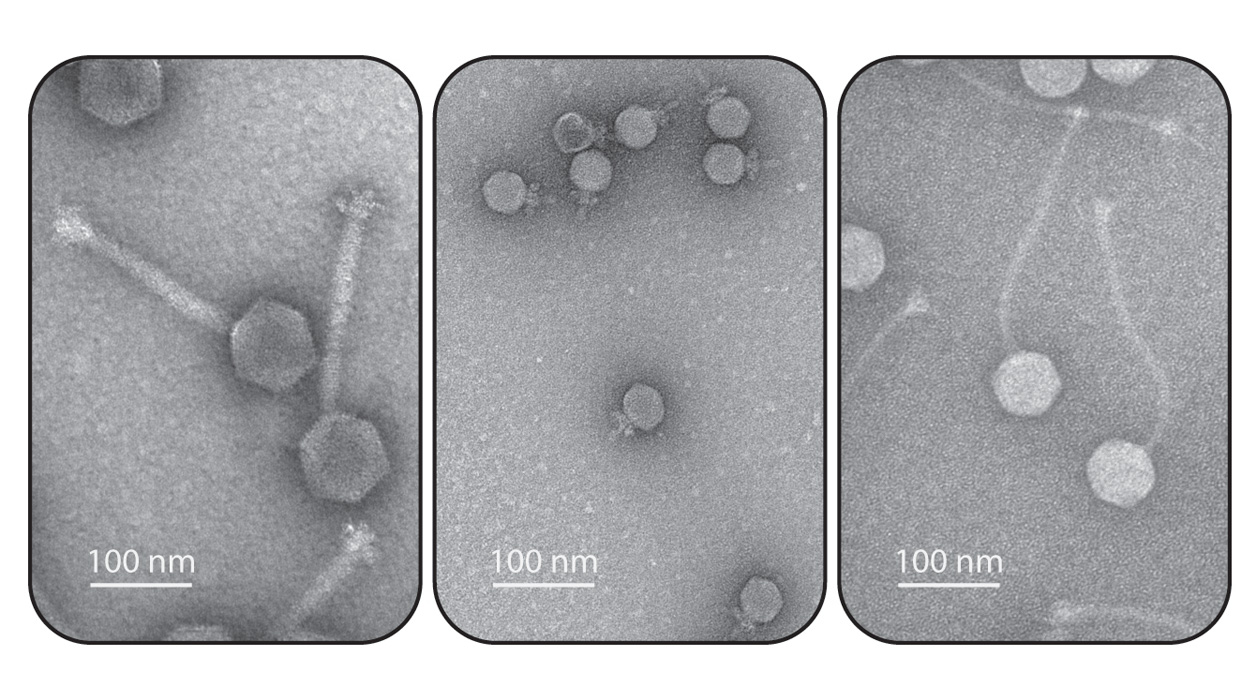 Electron micrographs of bacterial viruses, also known as phages. Photo credit is Hatoum-Aslan lab, University of Illinois Urbana-Champaign.