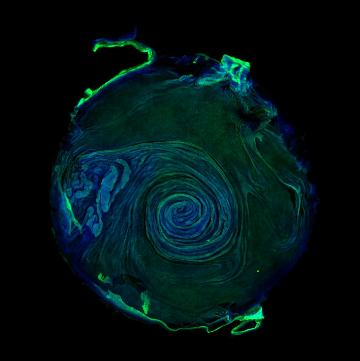 While the mechanisms driving activation of the innate immune response during viral infection are well understood, the spatial organization remains poorly defined. Using in vitro models of the respiratory tract, we aim to dissect how spatial structure shapes the activation of the innate immune response during influenza A virus infection.