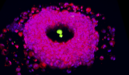 Liver progenitor cells (red) form a toroid shaped organoid around a PEG acrylate pillar. 