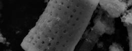 Cylindrical microparticles with a catalytic coating release tiny oxygen bubbles that coalesce and burst to disrupt stubborn biofilms on contaminated surgical instruments and infected wounds. / Yujin Ahn