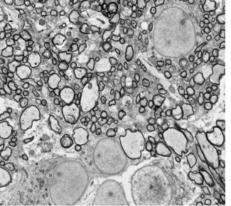 Piglet Corpus Callosum