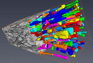 Section of piglet corpus callosum
