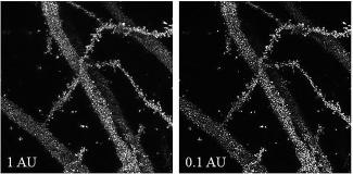 Golgi-Cox impregnated murine hippocampal neurons