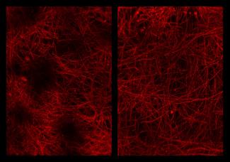 mouse medial prefontal cortex