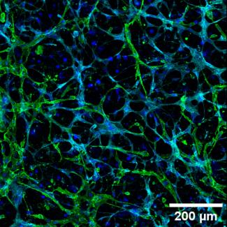 This is an image of a gelatin methacrylate model for the perivascular niche of the bone marrow.