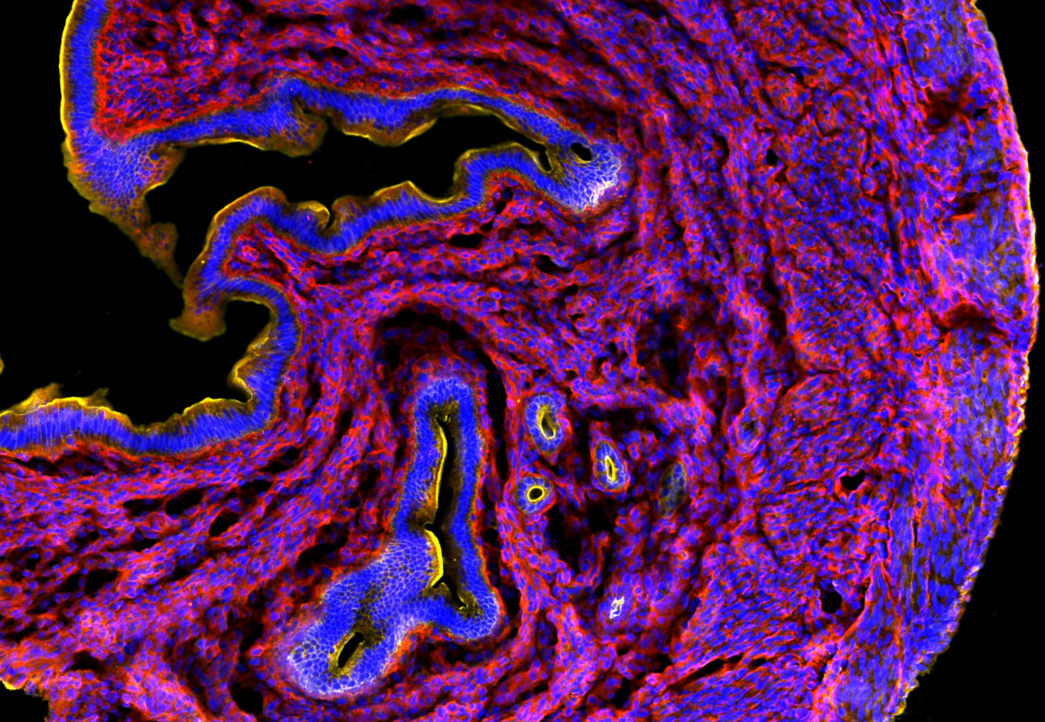 Image of a mouse uterine section in a study of in vivo exposure to DEHP and DINP. The stains are as follows: DAPI (blue), expression of CD31 (yellow), E-cadherin (red).