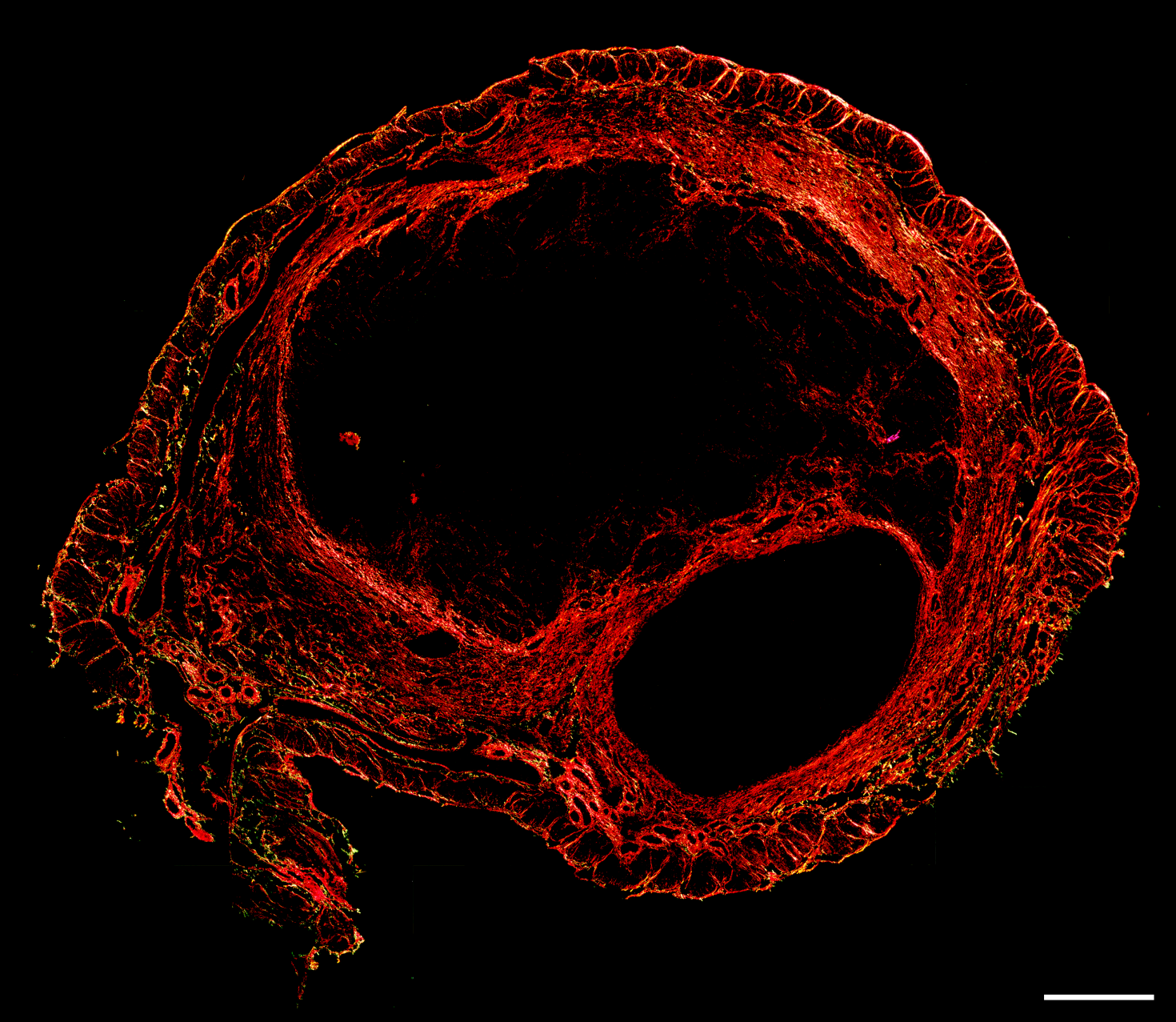 Representation of Picrosirius Red staining for collagen visualization in the uterus of a 9 month-old mouse. Picrosirius Red staining was performed to visualize collagen content in the uterus of a 9 month-old mouse under polarized light.
