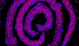 Confocal image of an 8 micron serial section containing the developing leaf primordia in the grass Setaria viridis (ME34) at 8 days after germination. 