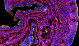 Image of a mouse uterine section in a study of in vivo exposure to DEHP and DINP. The stains are as follows: DAPI (blue), expression of CD31 (yellow), E-cadherin (red).