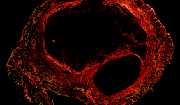 Representation of Picrosirius Red staining for collagen visualization in the uterus of a 9 month-old mouse. Picrosirius Red staining was performed to visualize collagen content in the uterus of a 9 month-old mouse under polarized light.