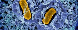 Scanning electron micrograph of Salmonella Typhimurium invading a human epithelial cell. S.Typhimurium has been decreasing in prevalence due to vaccinations by the poultry industry. Photo credit: National Institute of Allergy and Infectious Diseases
