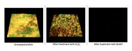 3D renderings of Pseudomonas aeruginosa biofilms show that treatment with SLAM particles can disrupt the bacterial biofilm and prevent regrowth.