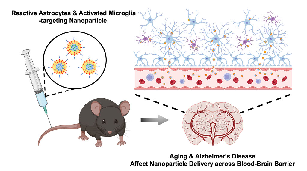 Nanoparticle transport across the blood brain barrier increases with Alzheimer’s and age, study finds