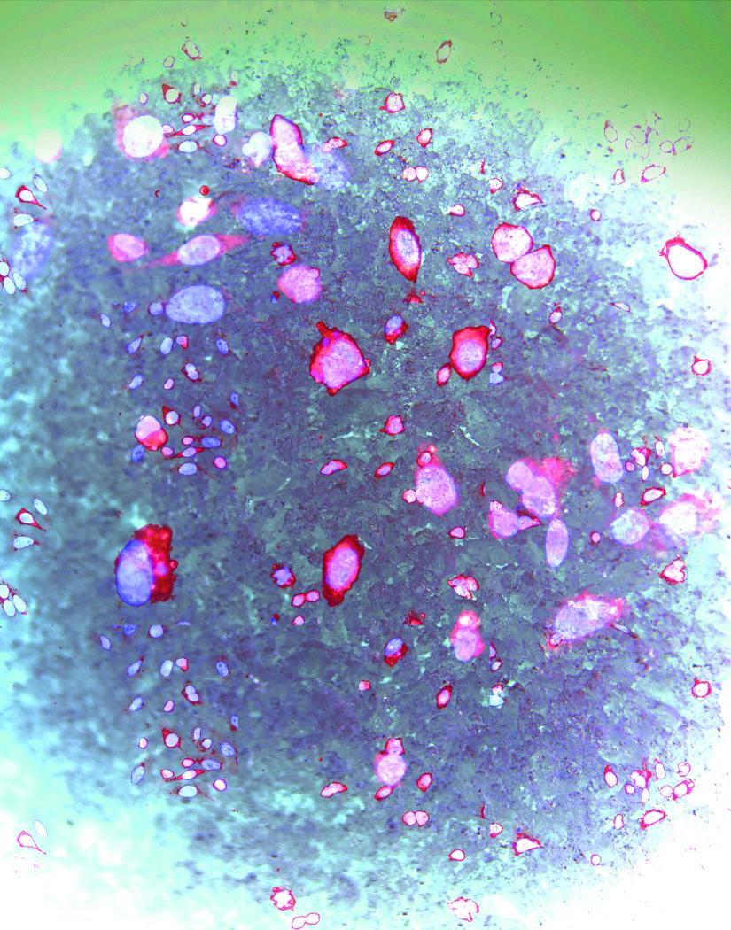 Subterfuge<br />
Axiovision image analysis<br />
Joanna Shisler and Ed Roy <br />
Joanna Shisler Laboratory<br />
Ed Roy Laboratory<br />
Funded by the NIH