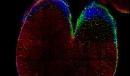 Two-photon image deep into the whole brain of a mouse fetus (Gestational Day 16.5) and post-processed with the Spectral Unmixing Module.