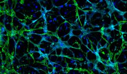 This is an image of a gelatin methacrylate model for the perivascular niche of the bone marrow.