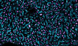 A section of mouse liver stained for ESRP2 and membrane-specific (CTNNB1) marker in a wildtype mouse. Inset: Timed activation of the ESRP2–miR-122 axis promotes hepatocyte binucleation and is linked with promoting hepatocyte quiescence.