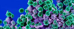 Staphylococcus epidermidis