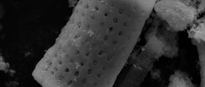 Cylindrical microparticles with a catalytic coating release tiny oxygen bubbles that coalesce and burst to disrupt stubborn biofilms on contaminated surgical instruments and infected wounds. / Yujin Ahn