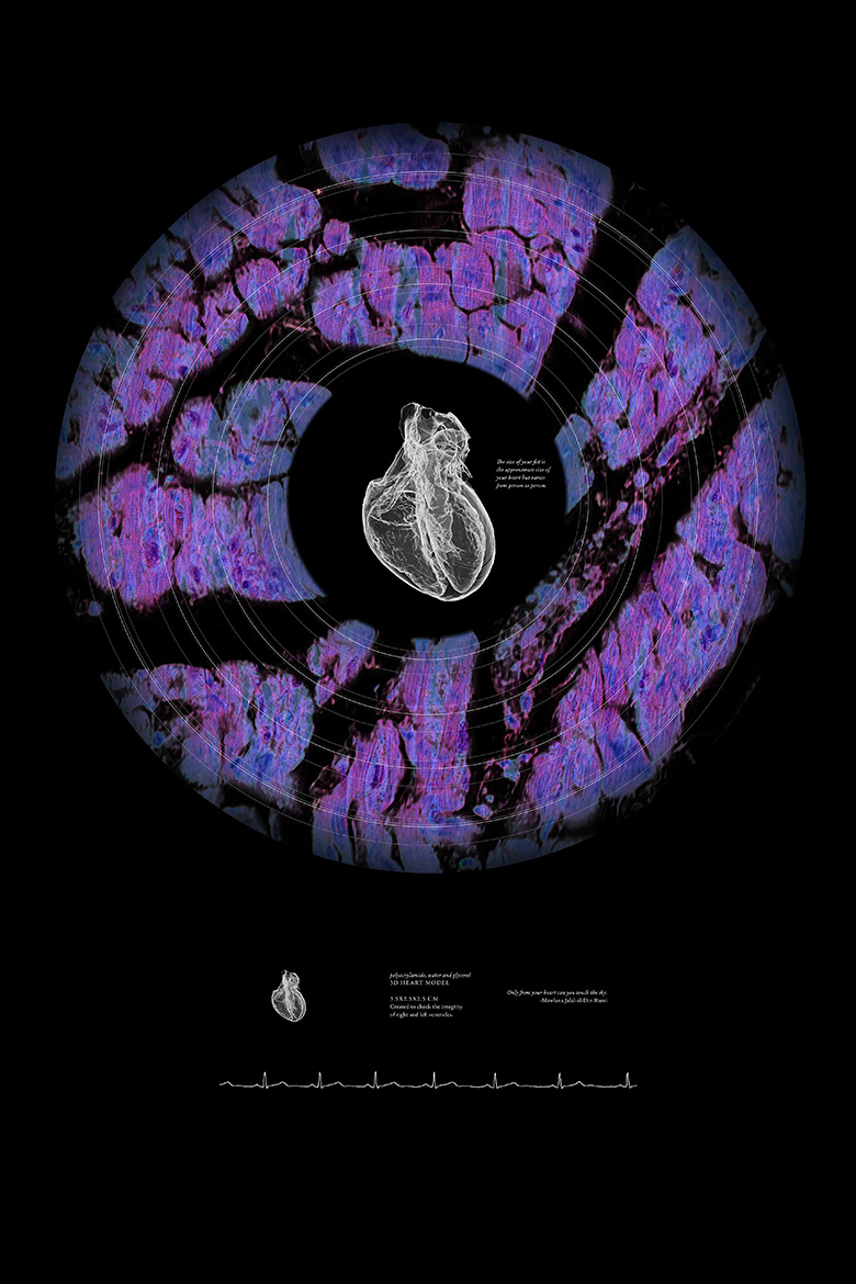 Joy's Bonfire<br />
Scientist Collaborator Joanne Vanessa Hwang<br />
Hyunjoon Kong Laboratory Group<br />
X5000 NSI High Resolution CT and rendered in 3D using Imaris 3D