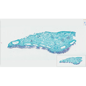 penicillium