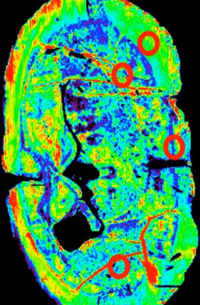 Infrared intensity map of lipid-associated band in brain shows regions with different lipid distributions.