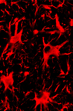 Spinal cord astrocytes, the cells seen in this fluorescent microscope image, are involved in the progression of ALS. A new CRISPR-Cas13 system targeting mutant protein production in these cells improved outcomes for mice with ALS.
