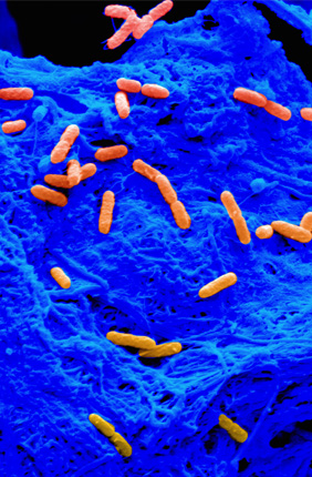 Individual Pseudomonas aeruginosa cells (orange) on the surface of the collagen scaffold (blue).