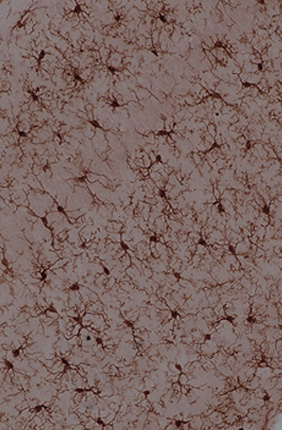 Immunohistochemical staining of Iba-1, a marker of microglial activation.