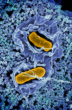 Scanning electron micrograph of Salmonella typhimurium invading a human epithelial cell. Credit: National Institute of Allergy and Infectious Diseases. 
