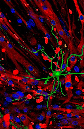 The researchers found that muscle with nerves released more of the brain-boosting factors than muscle without nerves. Pictured, from left: Professor Joon Kong and students Kai Yu Huang, Yujin An and Sehong Kang. |  Fred Zwicky