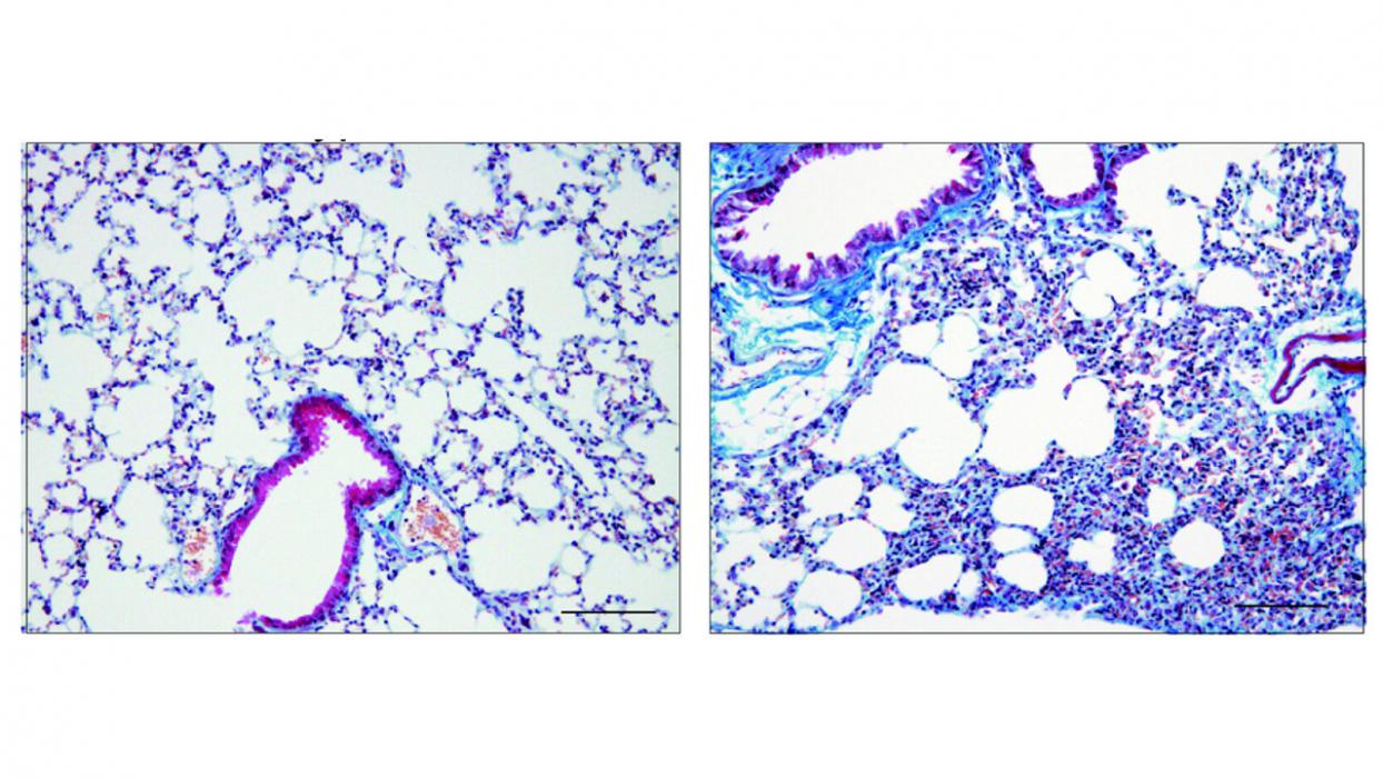 On the left, healthy mouse lung tissue. On the right, corisin-affected lung tissue shows extensive fibrosis. Image courtesy Esteban Gabazza