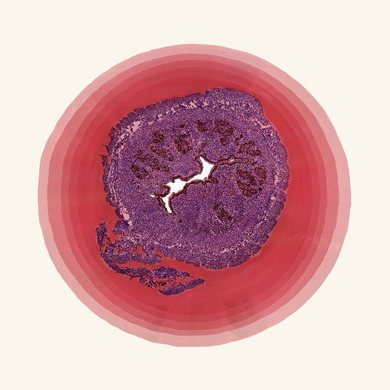 Art of Science image uterus sample