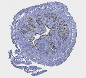 uterus cross section