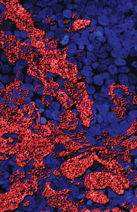 Defensive line<br />
Zeiss 710 LSM Confocal Microscope