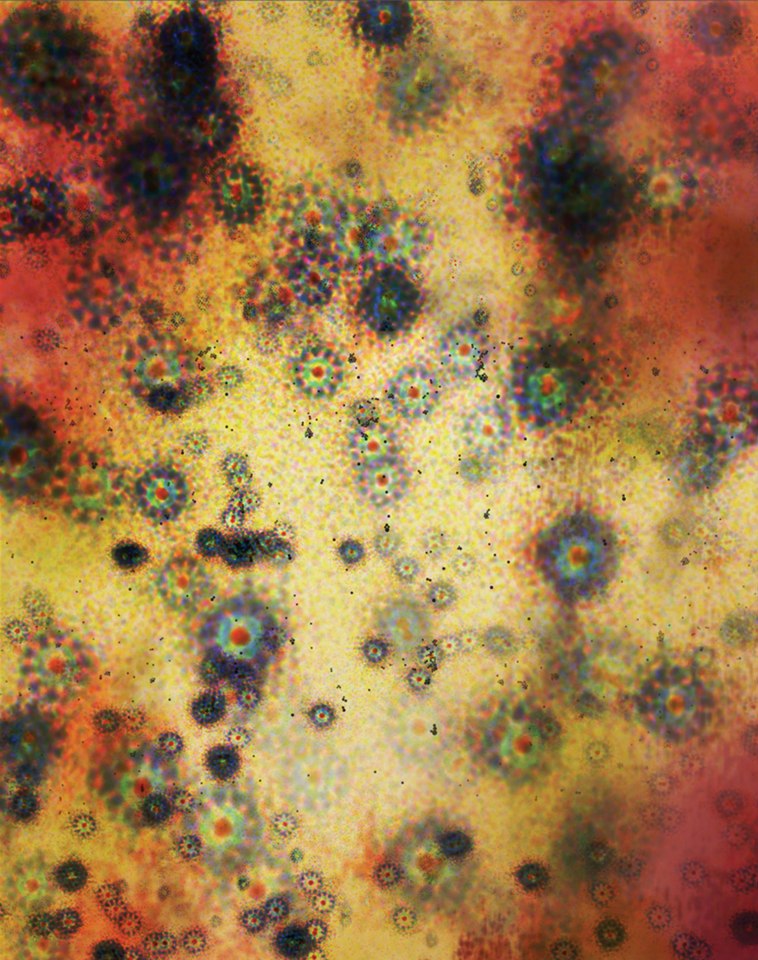 Zeiss Elyra SR-SIM Superresolution system