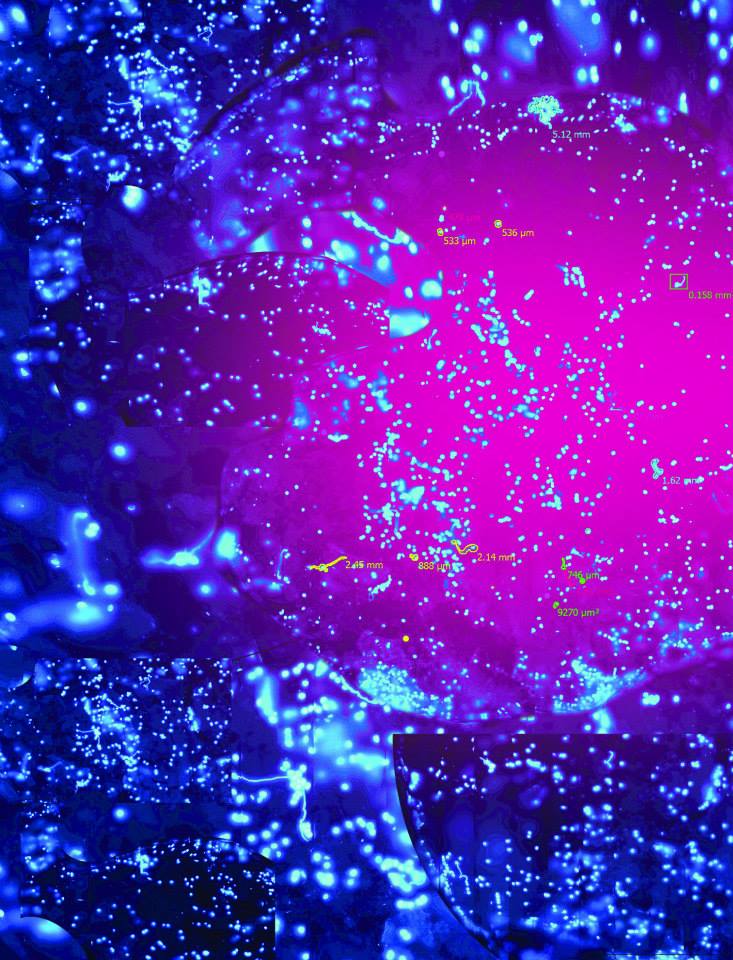 Girl power<br />
Nanozoomer Slide Scanner