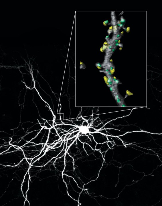 Restoring order<br />
Zeiss LSM 710 Confocal Microscope