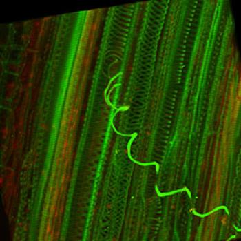 Eastern Filbert Blight