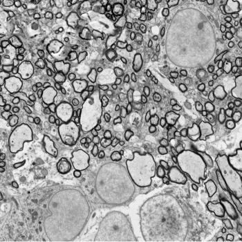 Piglet Corpus Callosum