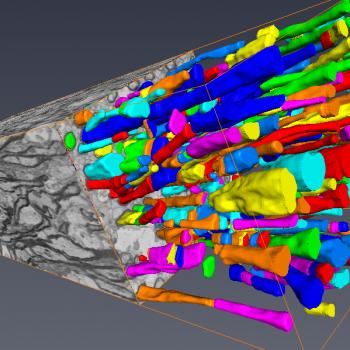 Section of piglet corpus callosum